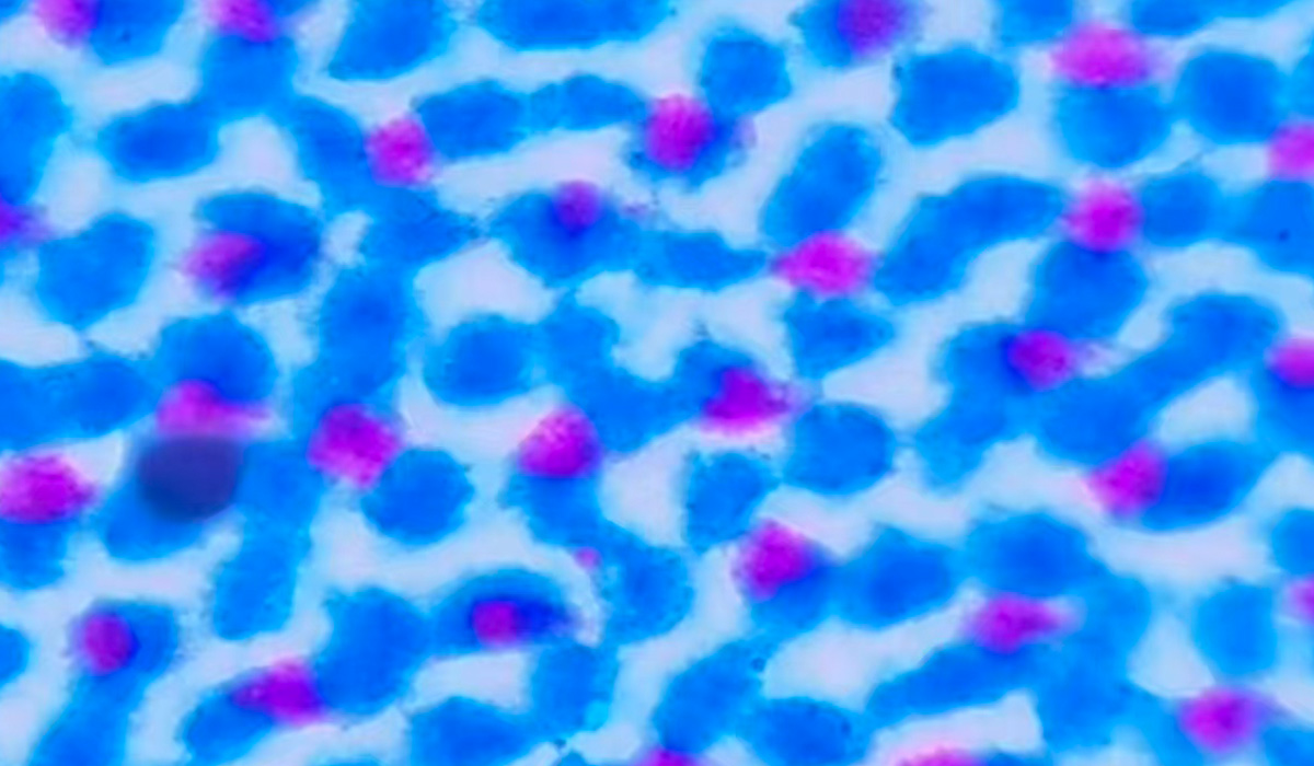 UV10